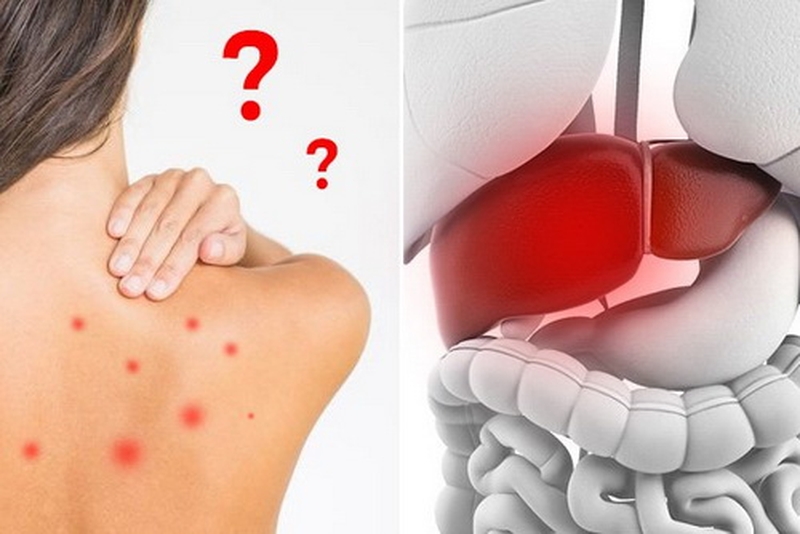 Gợi ý cách làm mứt dừa ngon chuẩn vị 2