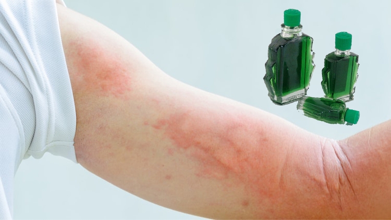 Gợi ý cách xông hơi giải cảm bằng dầu gió hiệu quả tại nhà 4