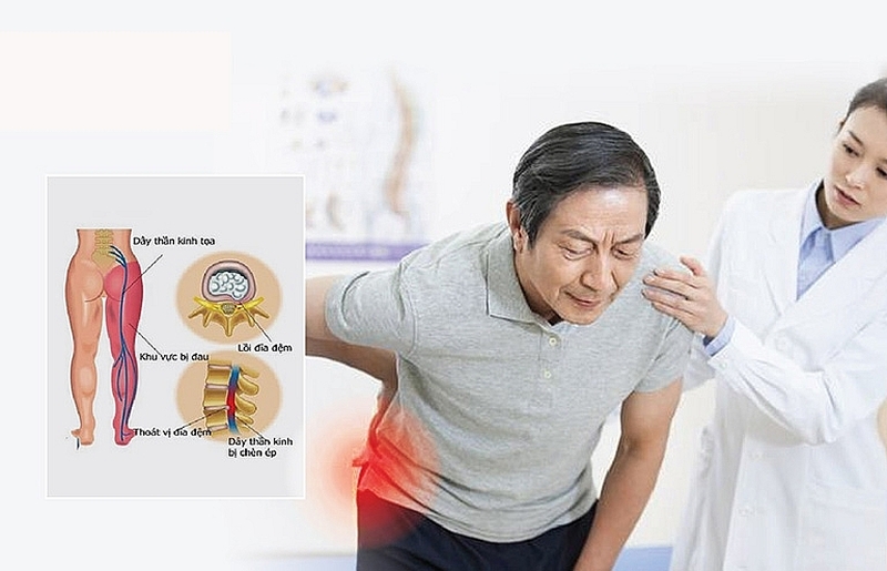 hỏi ý kiến bác sĩ nếu đi lại khó khăn