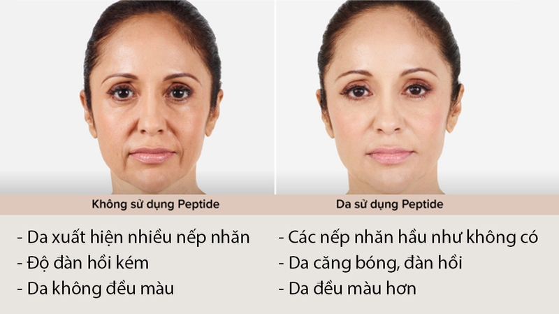 Hoạt chất Peptide kết hợp với thành phần gì giúp tăng hiệu quả chống lão hóa da 1