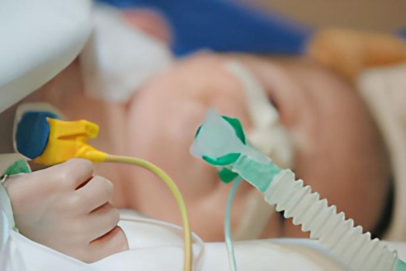 Hội chứng Pallister - Killian: Triệu chứng, phương pháp chẩn đoán và cách điều trị