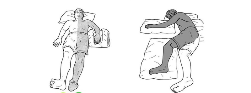 Hội chứng Weber: Nguyên nhân, triệu chứng, cách điều trị và phòng ngừa 2