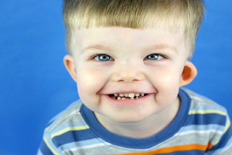 Hội chứng William là gì? Nguyên nhân, triệu chứng và cách điều trị 2