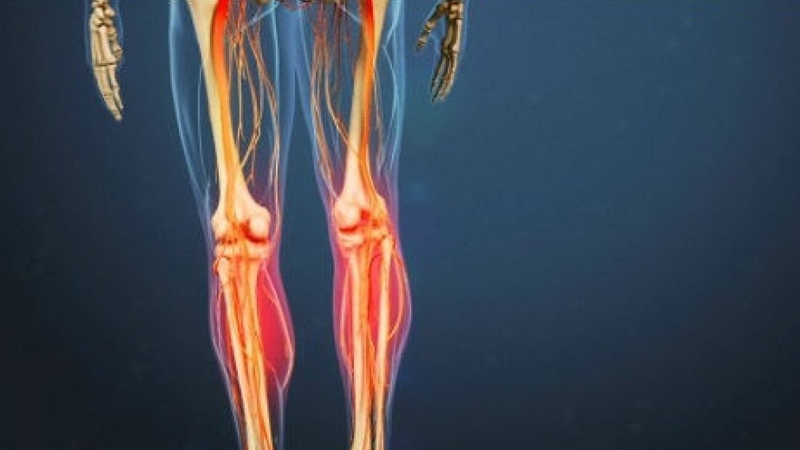 Hội chứng đuôi ngựa:Nguyên nhân, triệu chứng và cách điều trị 2