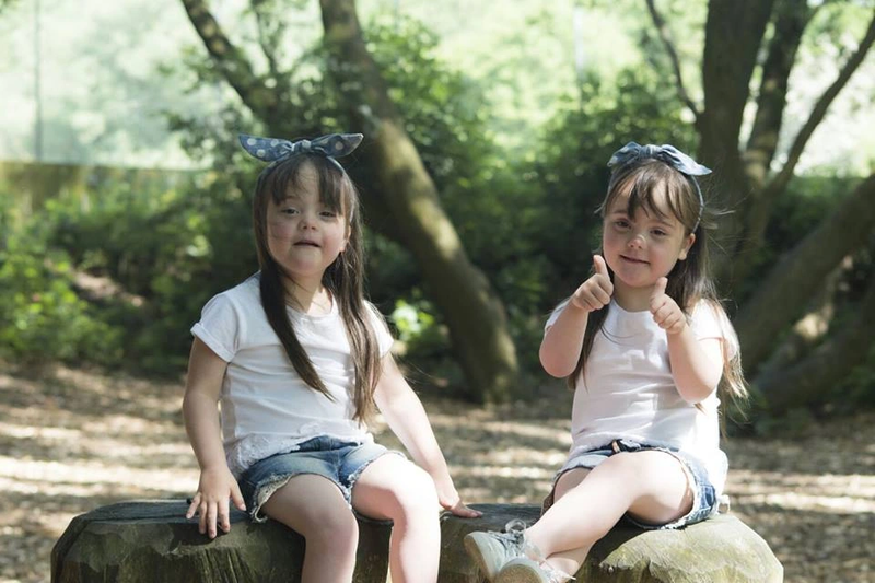 Hội chứng thiên thần (Angelman syndrome) 3