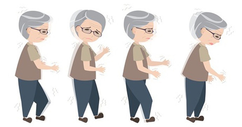 Hội chứng tiền đình cấp là gì Triệu chứng và cách điều trị ra sao 3