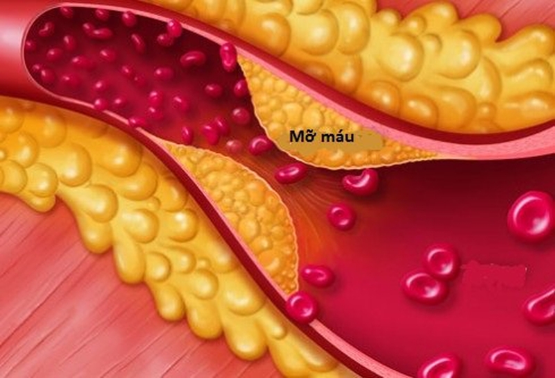 Hướng dẫn cách làm thạch dưa hấu ngon miệng và đẹp mắt 2