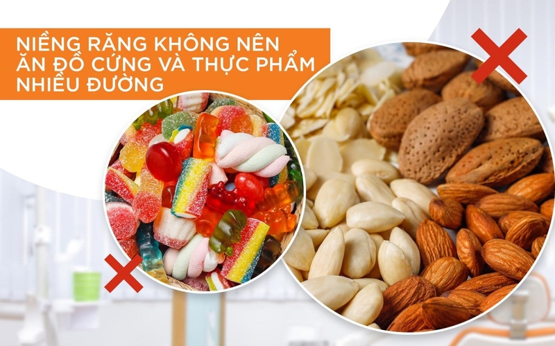 Hướng dẫn vệ sinh răng miệng khi mang mắc cài trong thời gian niềng răng 3