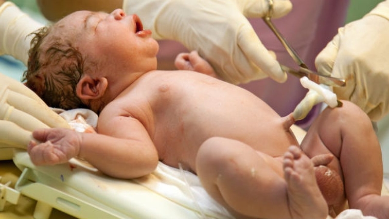 Kẹp cắt rốn chậm là gì? Lợi ích của phương pháp kẹp cắt dây rốn chậm có thể bạn chưa biết 2