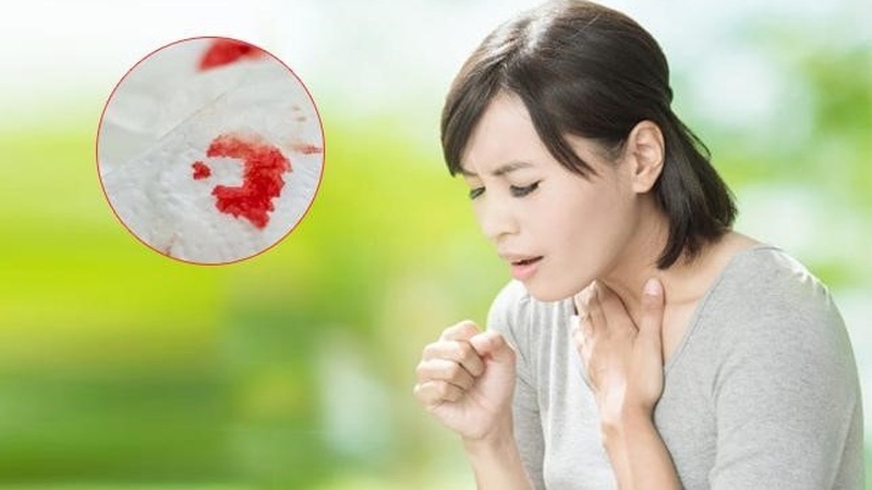 Tìm hiểu nguyên nhân và cách điều trị khi bị khạc đờm ra máu 1