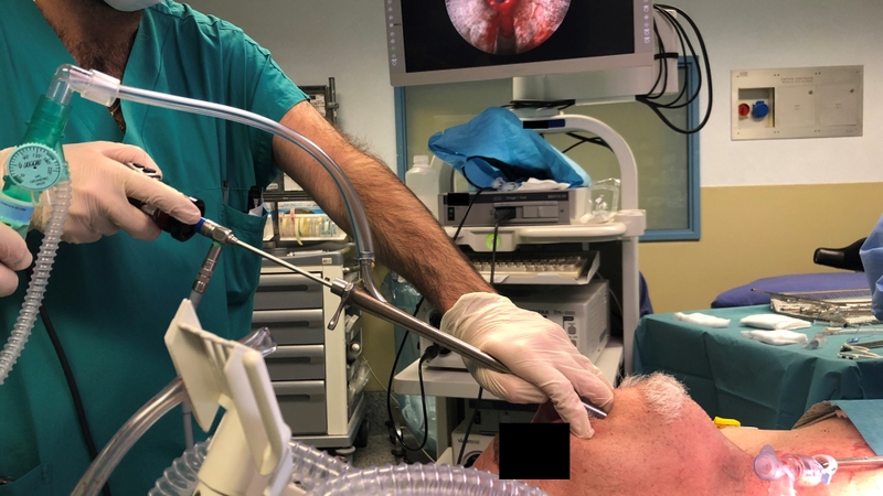 Khi nào cần nội soi phế quản: Dấu hiệu cơ bản nhận biết 3