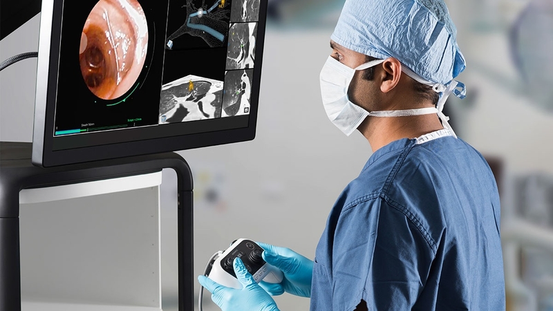 Khi nào cần nội soi phế quản: Dấu hiệu cơ bản nhận biết 4