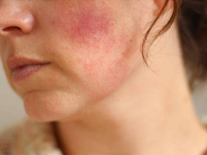 Tiêm vitamin C- Những điều cần biết 4