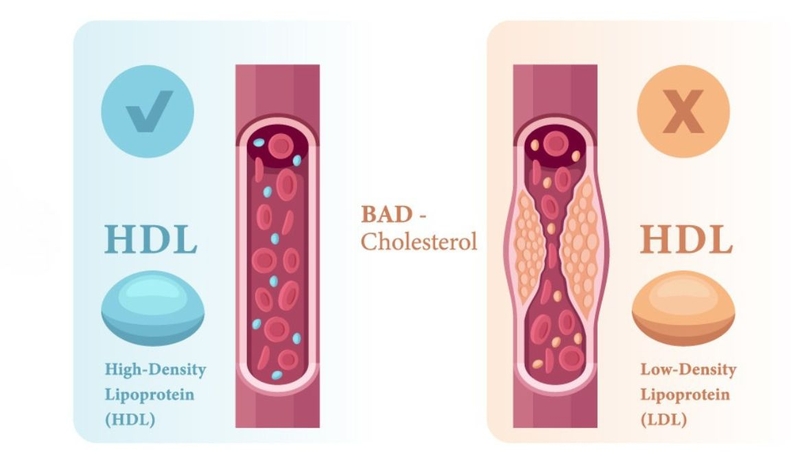 LDL cholesterol là gì? Những điều cần biết để bảo vệ tim mạch 1