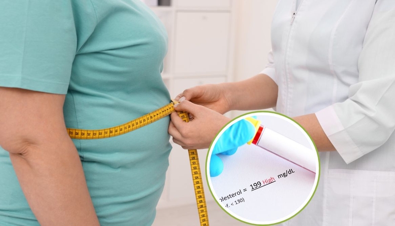 LDL cholesterol là gì? Những điều cần biết để bảo vệ tim mạch 3