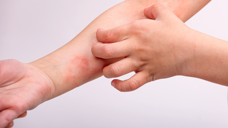 Các chất chống oxy hóa và kháng viêm trong lá khổ qua rừng có thể hỗ trợ cải thiện tình trạng da