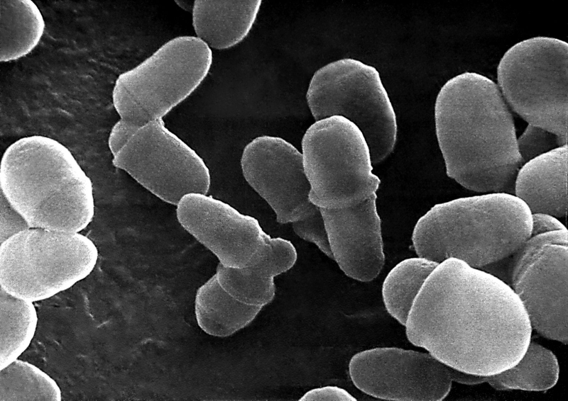 Lang ben bôi thuốc gì hiệu quả? 1