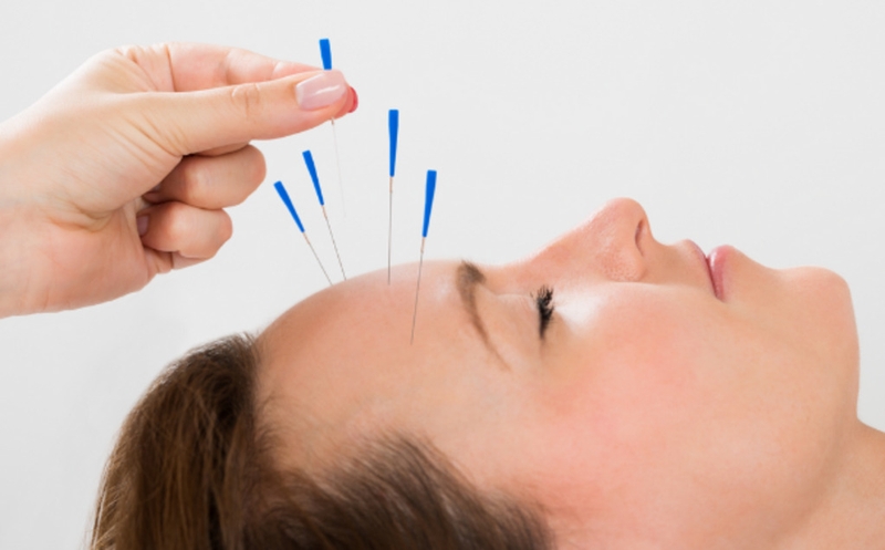 Liệt dây thần kinh số 7 3