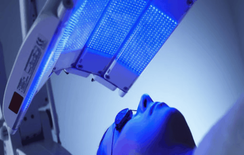 Lieu-phap-dieu-tri-mun-bang-anh-sang-xanh-co-hieu-qua-khong 2.png