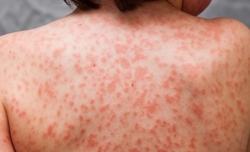 Lưỡi dâu tây 03