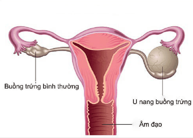 Lý giải hiện tượng que thử thai không lên vạch nào 3