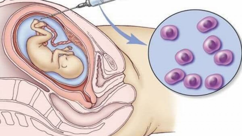 Mang thai bao nhiêu tuần thì biết trai hay gái? 4