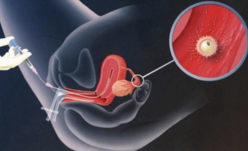 mang-thai-ho-va-cac-van-de-lien-quan 3