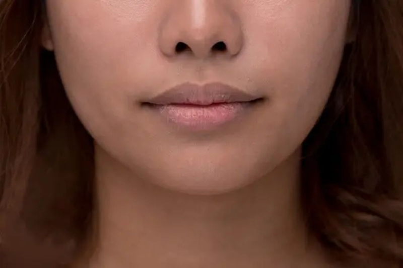 Mặt nạ môi có tác dụng gì? Những điều cần biết khi lựa chọn mặt nạ môi 3