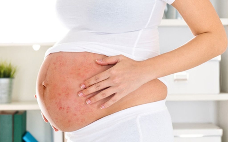 Mẹ bầu bị zona thần kinh bôi thuốc gì để nhanh khỏi và an toàn cho mẹ và bé? 2