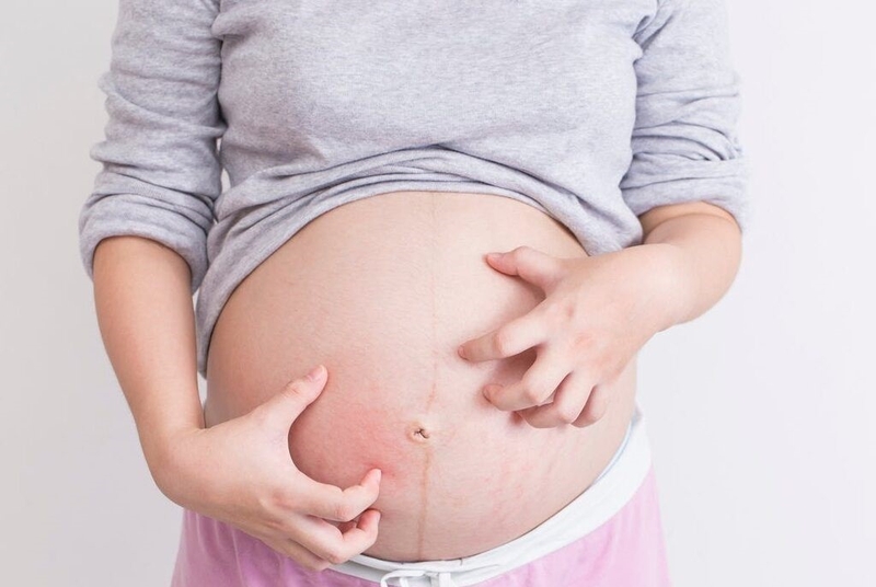 Mẹ bầu gãi bụng có ảnh hưởng đến thai nhi không? Cách xử trí ngứa bụng hiệu quả 3