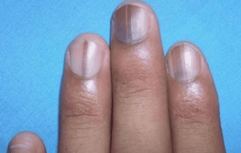 Mong-tay-den-co-nguy-hiem-khong 3.png