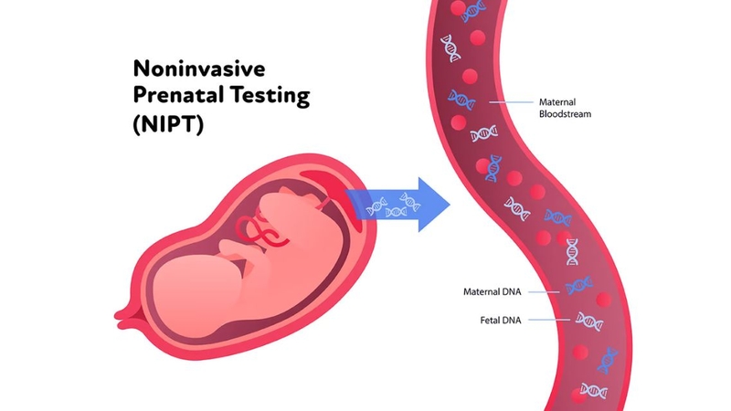 NIPT 9.5 giúp phát hiện 9 bất thường nhiễm sắc thể phổ biến
