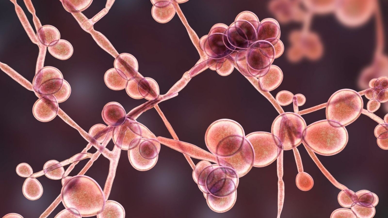 Nấm miệng nặng: Nguyên nhân, biến chứng và điều trị 5