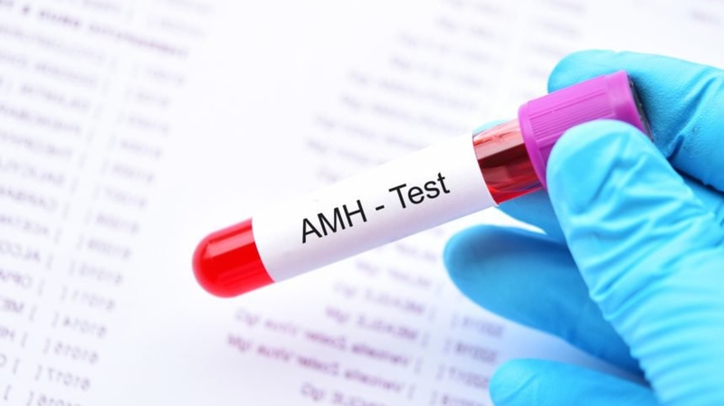 Nên xét nghiệm AMH vào thời điểm nào?3