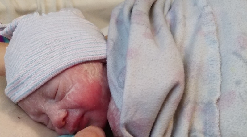 Nếu trẻ không khóc, bác sĩ sẽ đánh giá tình trạng trẻ trên thang điểm Apgar 3