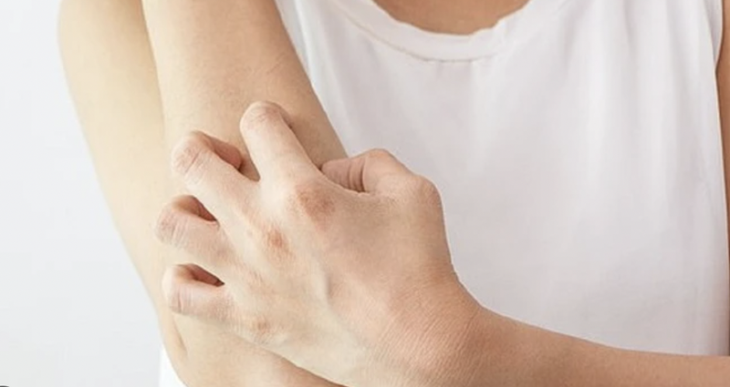 ngua-gai-bi-bam-tim-va-nhung-dieu-can-biet 2