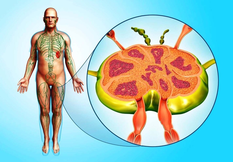 Nguyên nhân gây nổi hạch ở nách trái nam giới và phương pháp xử trí mà bạn nên biết 4