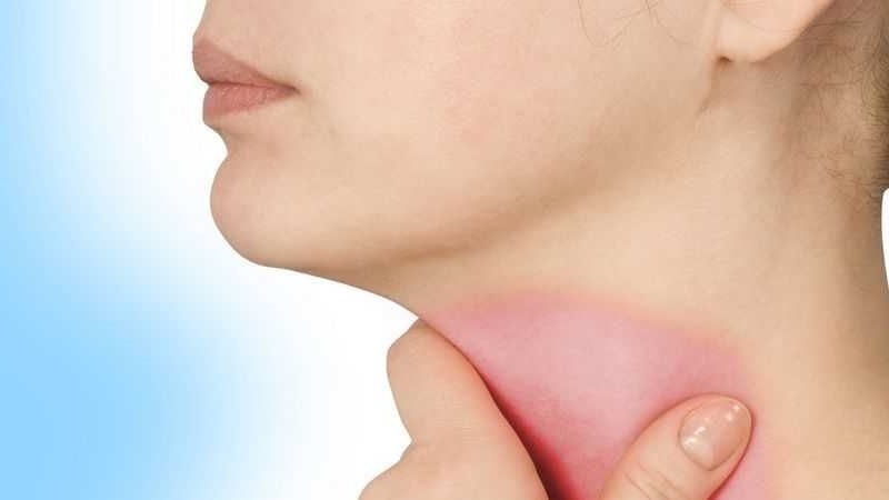 Nguyên nhân khiến viêm amidan tái phát nhiều lần