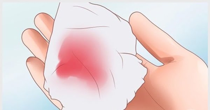 Nhận biết các dấu hiệu bạn nên tháo vòng tránh thai 3