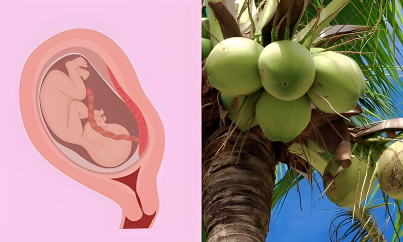 Nhau thai bám thấp có nên uống nước dừa không? Những lưu ý khi bị nhau thai bám thấp 4
