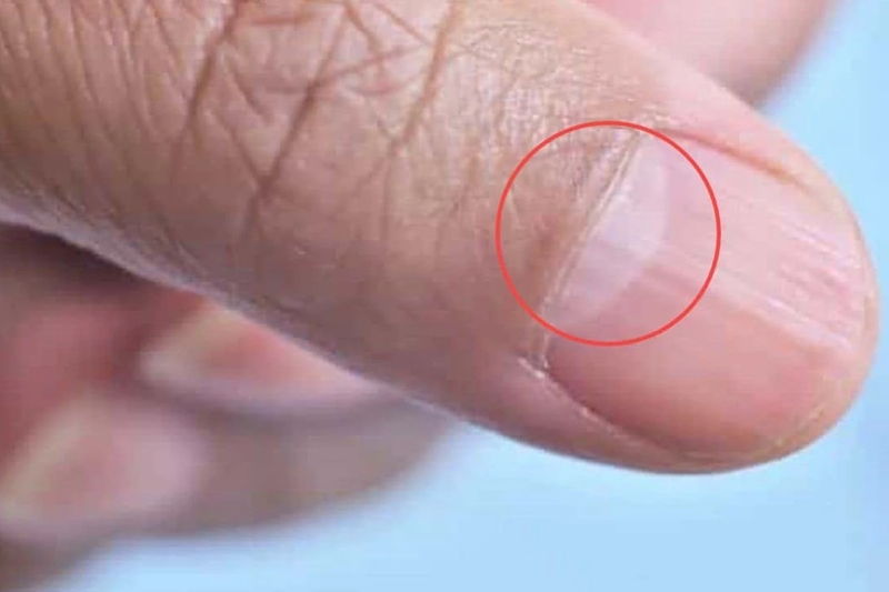 Nhìn hình bán nguyệt trên móng tay biết được điều gì về sức khỏe? 1