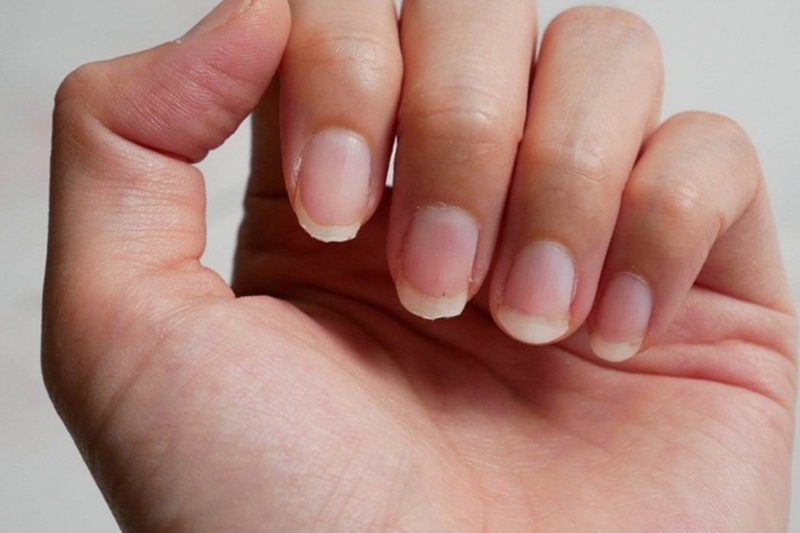 Nhìn hình bán nguyệt trên móng tay biết được điều gì về sức khỏe? 2