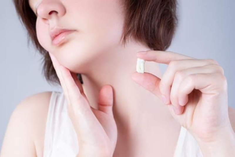 Nhổ răng xong uống thuốc gì? 1