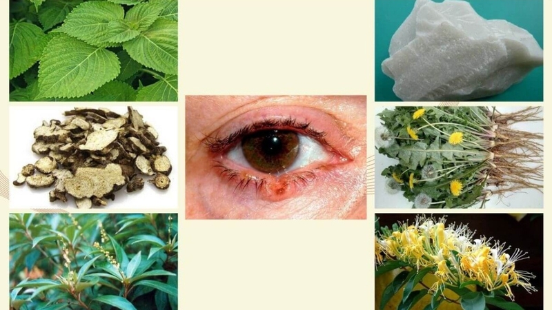 cach-chua-viem-bo-mi-bang-thuoc-nam-hieu-qua-3