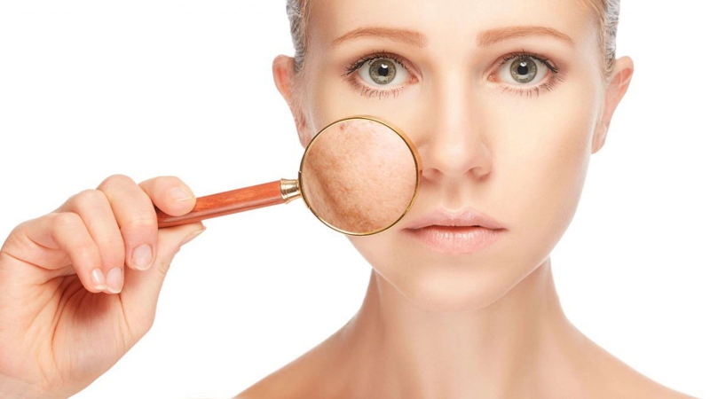 thức khuya khiến da sạm, bong tróc, mất độ ẩm