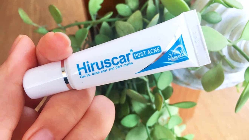 Những cách đơn giản giúp "tạm biệt" thâm mụn nhanh chóng 2