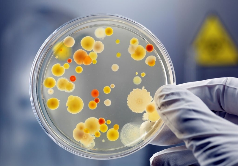 Những điều cần biết về u nấm phổi: Triệu chứng và cách điều trị 3