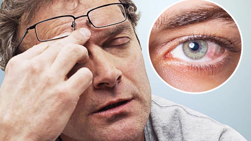 Những tác hại khi sử dụng máy lạnh nhiều vào mùa hè 1