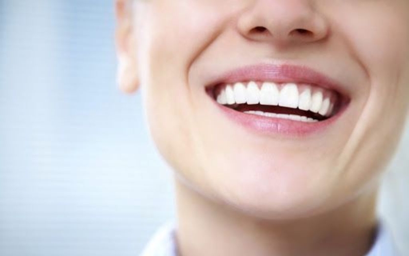 Niềng răng có gây đau không? Tác dụng và lợi ích khi niềng răng 3