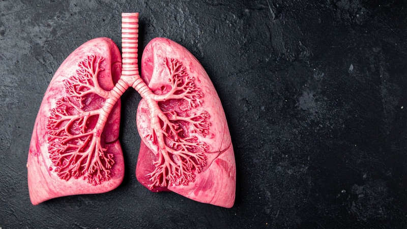 Nintedanib được chỉ định cho bệnh xơ phổi vô căn